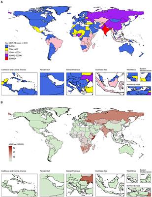 Tracking multidrug resistant tuberculosis: a 30-year analysis of global, regional, and national trends